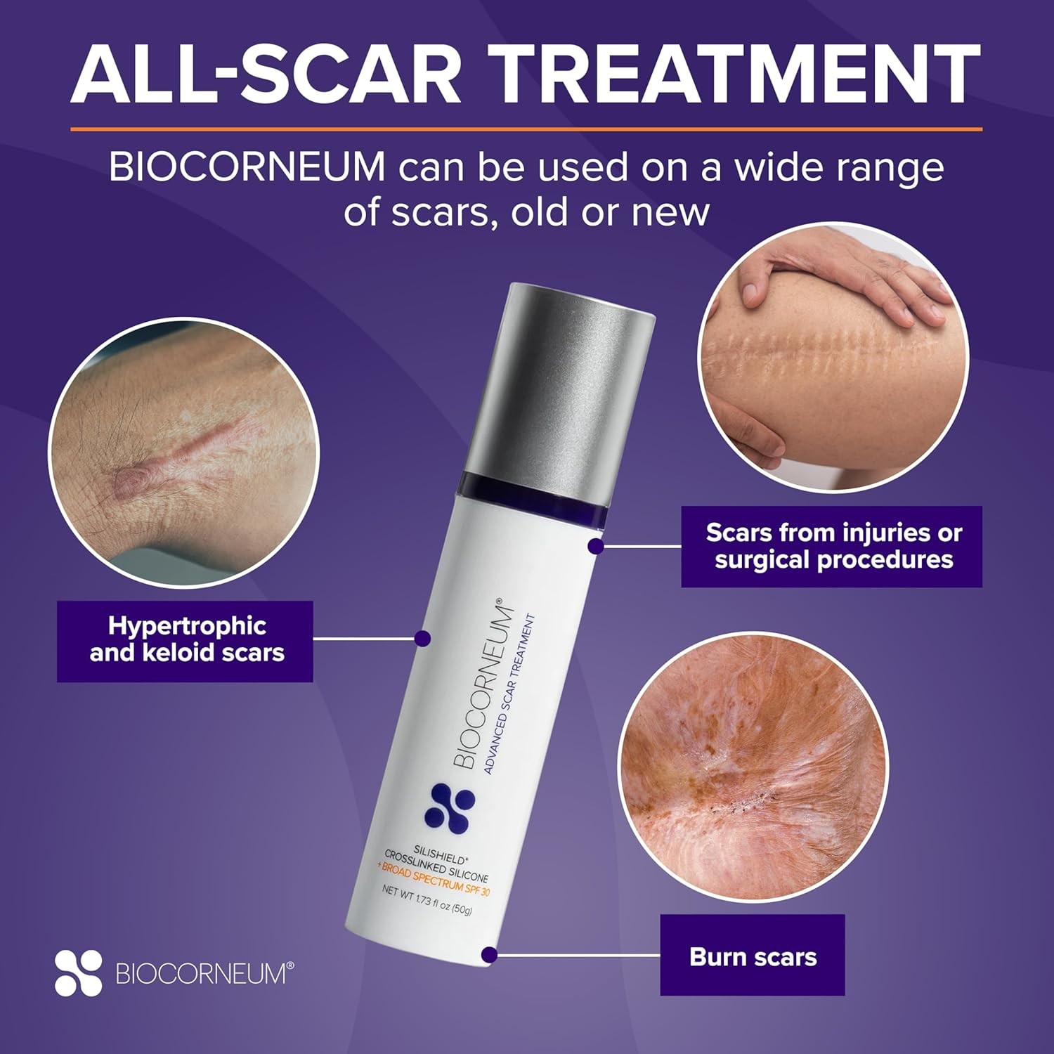 Advanced Scar Treatment with Silishield? & SPF 30 10g ?C Made in the USA, Fast-